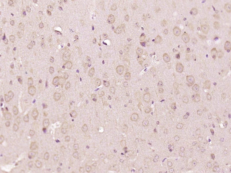 Paraformaldehyde-fixed, paraffin embedded Mouse brain; Antigen retrieval by boiling in sodium citrate buffer (pH6.0) for 15min; Block endogenous peroxidase by 3% hydrogen peroxide for 20 minutes; Blocking buffer (normal goat serum) at 37°C for 30min; Antibody incubation with RBM25 Polyclonal Antibody, Unconjugated (bs-19768R) at 1:500 overnight at 4°C, DAB staining.