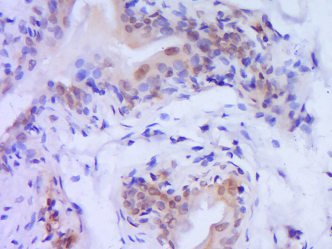 Paraformaldehyde-fixed, paraffin embedded Rat bladder; Antigen retrieval by boiling in sodium citrate buffer (pH6.0) for 15min; Block endogenous peroxidase by 3% hydrogen peroxide for 20 minutes; Blocking buffer (normal goat serum) at 37°C for 30min; Antibody incubation with Caspase-9 Polyclonal Antibody, Unconjugated (bs-20773R) at 1:400 overnight at 4°C, DAB staining.