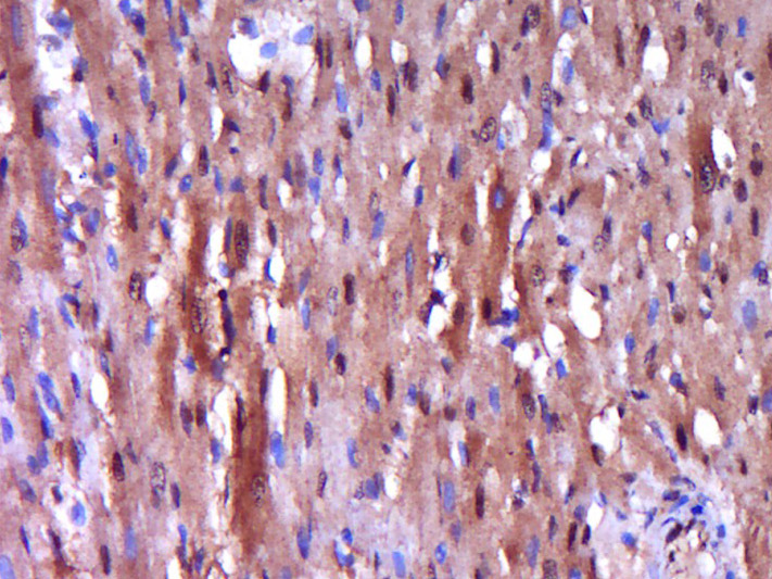 Paraformaldehyde-fixed, paraffin embedded Rat heart; Antigen retrieval by boiling in sodium citrate buffer (pH6.0) for 15min; Block endogenous peroxidase by 3% hydrogen peroxide for 20 minutes; Blocking buffer (normal goat serum) at 37°C for 30min; Antibody incubation with Caspase-9 Polyclonal Antibody, Unconjugated (bs-20773R) at 1:400 overnight at 4°C, DAB staining.