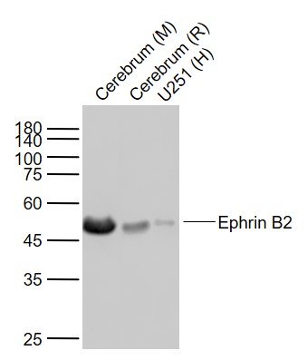 Lane 1: Mouse Cerebrum lysates; Lane 2: Rat Cerebrum lysates; Lane 3: Human U251 cell lysates probed with Ephrin B2 (3A7) Monoclonal Antibody, Unconjugated (bsm-54090R) at 1:1000 dilution and 4˚C overnight incubation. Followed by conjugated secondary antibody incubation at 1:20000 for 60 min at 37˚C.