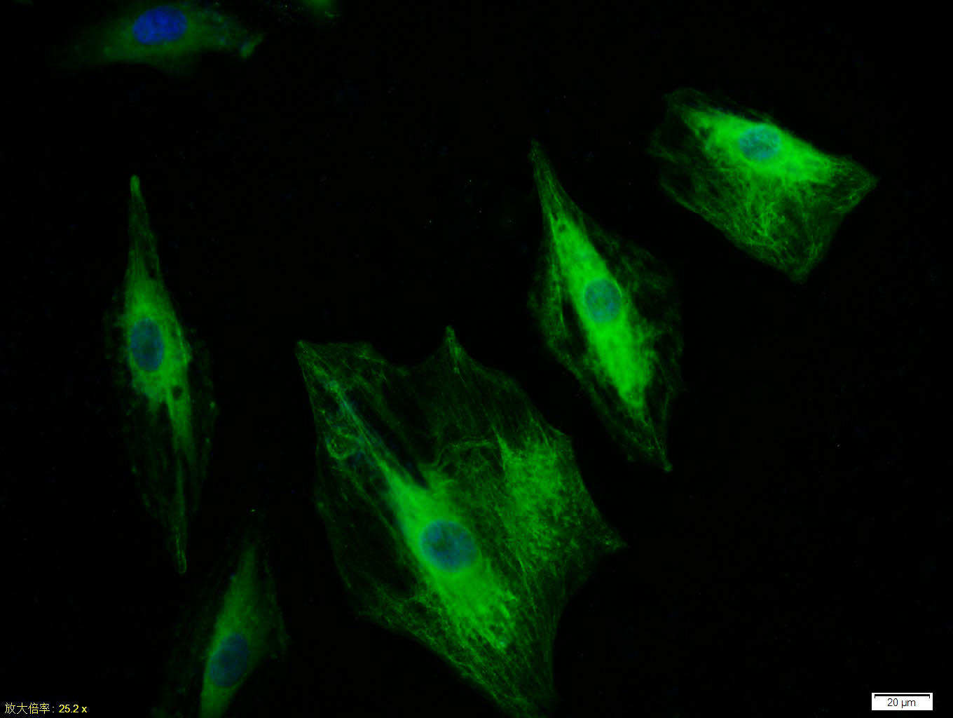 Tissue/cell:A549 cell; 4% Paraformaldehyde-fixed; Triton X-100 at room temperature for 20 min; Blocking buffer (normal goat serum,C-0005) at 37°C for 20 min; Antibody incubation with (CK18) polyclonal Antibody, Unconjugated (bs-1339R) 1:100, 90 minutes at 37°C; followed by a FITC conjugated Goat Anti-Rabbit IgG antibody at 37°C for 90 minutes, DAPI (blue, C02-04002) was used to stain the cell nuclei.