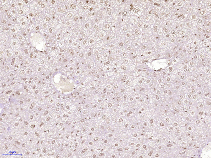 Paraformaldehyde-fixed, paraffin embedded Mouse liver; Antigen retrieval by boiling in sodium citrate buffer (pH6.0) for 15min; Block endogenous peroxidase by 3% hydrogen peroxide for 20 minutes; Blocking buffer (normal goat serum) at 37°C for 30min; Antibody incubation with SLIRP/C14orf156 Polyclonal Antibody, Unconjugated (bs-21033R) at 1:400 overnight at 4°C, DAB staining.