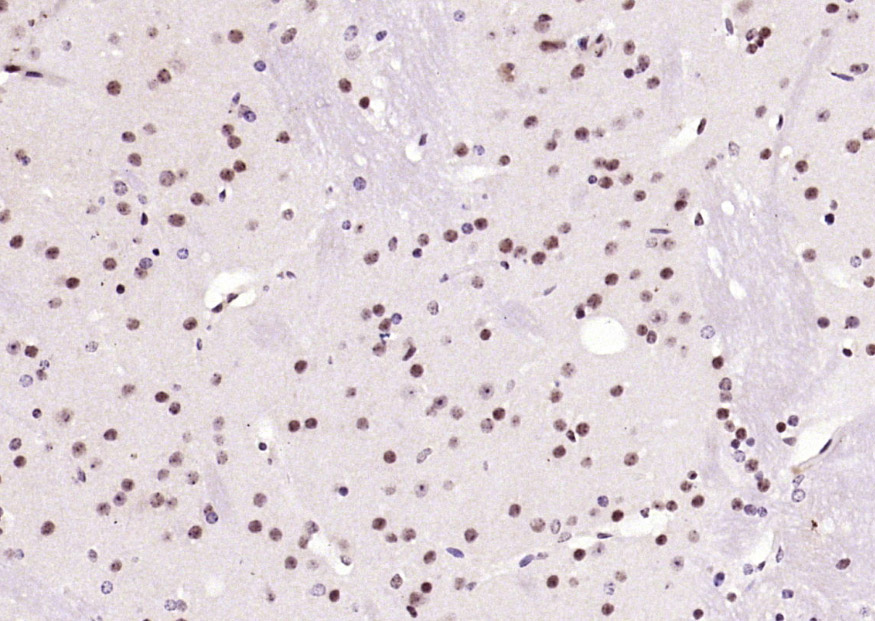 Paraformaldehyde-fixed, paraffin embedded Mouse brain; Antigen retrieval by boiling in sodium citrate buffer (pH6.0) for 15min; Block endogenous peroxidase by 3% hydrogen peroxide for 20 minutes; Blocking buffer (normal goat serum) at 37°C for 30min; Antibody incubation with RNF105 Polyclonal Antibody, Unconjugated (bs-22472R) at 1:200 overnight at 4°C, DAB staining.