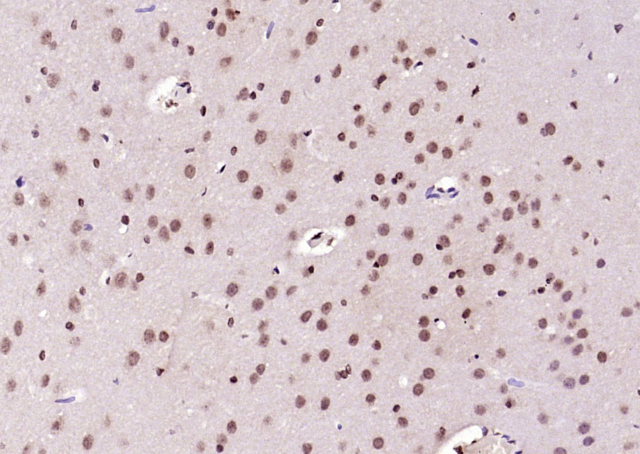 Paraformaldehyde-fixed, paraffin embedded Rat brain; Antigen retrieval by boiling in sodium citrate buffer (pH6.0) for 15min; Block endogenous peroxidase by 3% hydrogen peroxide for 20 minutes; Blocking buffer (normal goat serum) at 37°C for 30min; Antibody incubation with RNF105 Polyclonal Antibody, Unconjugated (bs-22472R) at 1:200 overnight at 4°C, DAB staining.