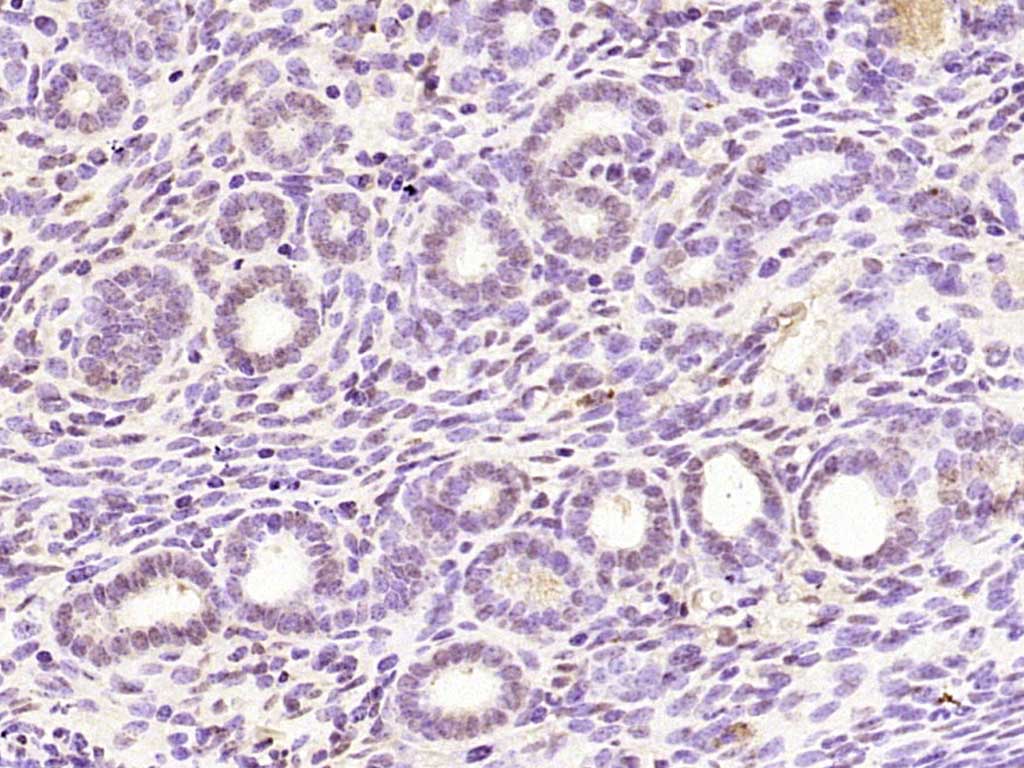 Paraformaldehyde-fixed, paraffin embedded Mouse uterus; Antigen retrieval by boiling in sodium citrate buffer (pH6.0) for 15min; Block endogenous peroxidase by 3% hydrogen peroxide for 20 minutes; Blocking buffer (normal goat serum) at 37°C for 30min; Antibody incubation with PAX7 Polyclonal Antibody, Unconjugated (bs-22741R) at 1:2000 overnight at 4°C, DAB staining.