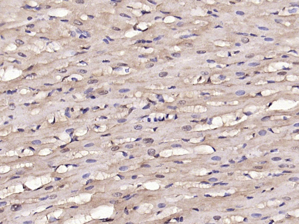 Paraformaldehyde-fixed, paraffin embedded Rat heart; Antigen retrieval by boiling in sodium citrate buffer (pH6.0) for 15min; Block endogenous peroxidase by 3% hydrogen peroxide for 20 minutes; Blocking buffer (normal goat serum) at 37°C for 30min; Antibody incubation with phospho-SNAIL + SLUG (Ser246) Polyclonal Antibody, Unconjugated (bs-22884R) at 1:200 overnight at 4°C, DAB staining.