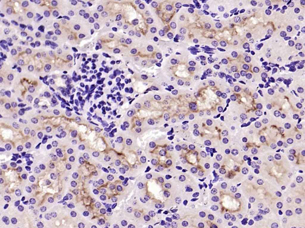 Paraformaldehyde-fixed, paraffin embedded Mouse kidney; Antigen retrieval by boiling in sodium citrate buffer (pH6.0) for 15min; Block endogenous peroxidase by 3% hydrogen peroxide for 20 minutes; Blocking buffer (normal goat serum) at 37°C for 30min; Antibody incubation with ACE2 Polyclonal Antibody, Unconjugated (bs-41410R) at 1:200 overnight at 4°C, DAB staining.