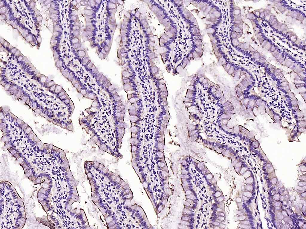 Paraformaldehyde-fixed, paraffin embedded Rat intestine; Antigen retrieval by boiling in sodium citrate buffer (pH6.0) for 15min; Block endogenous peroxidase by 3% hydrogen peroxide for 20 minutes; Blocking buffer (normal goat serum) at 37°C for 30min; Antibody incubation with ACE2 Polyclonal Antibody, Unconjugated (bs-41410R) at 1:200 overnight at 4°C, DAB staining.