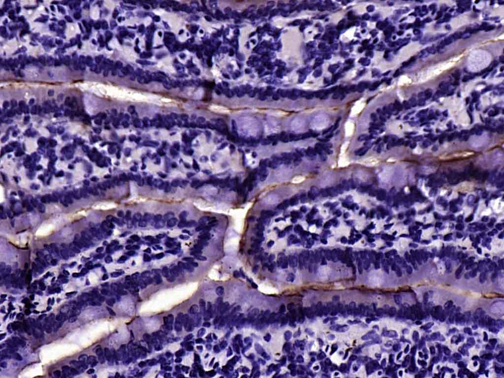 Paraformaldehyde-fixed, paraffin embedded Human intestine; Antigen retrieval by boiling in sodium citrate buffer (pH6.0) for 15min; Block endogenous peroxidase by 3% hydrogen peroxide for 20 minutes; Blocking buffer (normal goat serum) at 37°C for 30min; Antibody incubation with ACE2 Polyclonal Antibody, Unconjugated (bs-41410R) at 1:200 overnight at 4°C, DAB staining.