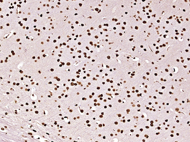 Paraformaldehyde-fixed, paraffin embedded Mouse brain; Antigen retrieval by boiling in sodium citrate buffer (pH6.0) for 15min; Block endogenous peroxidase by 3% hydrogen peroxide for 20 minutes; Blocking buffer (normal goat serum) at 37°C for 30min; Antibody incubation with Histone H3(mono methyl K79) Monoclonal Antibody, Unconjugated (bsm-33104M) at 1:400 overnight at 4°C, DAB staining.