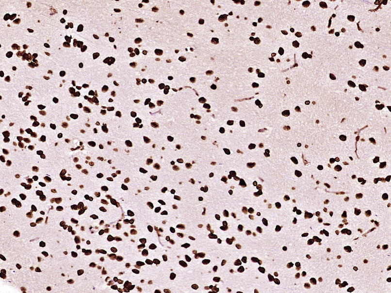 Paraformaldehyde-fixed, paraffin embedded Rat brain; Antigen retrieval by boiling in sodium citrate buffer (pH6.0) for 15min; Block endogenous peroxidase by 3% hydrogen peroxide for 20 minutes; Blocking buffer (normal goat serum) at 37°C for 30min; Antibody incubation with Histone H3(mono methyl K79) Monoclonal Antibody, Unconjugated (bsm-33104M) at 1:400 overnight at 4°C, DAB staining.