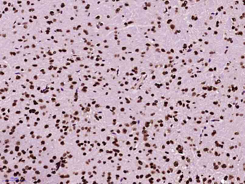 Paraformaldehyde-fixed, paraffin embedded Mouse brain; Antigen retrieval by boiling in sodium citrate buffer (pH6.0) for 15min; Block endogenous peroxidase by 3% hydrogen peroxide for 20 minutes; Blocking buffer (normal goat serum) at 37°C for 30min; Antibody incubation with Histone H3(di methyl K79) Monoclonal Antibody, Unconjugated (bsm-33123M) at 1:400 overnight at 4°C, DAB staining.