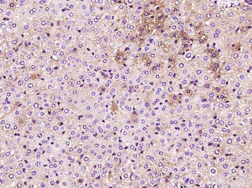 Paraformaldehyde-fixed, paraffin embedded Mouse liver; Antigen retrieval by boiling in sodium citrate buffer (pH6.0) for 15min; Block endogenous peroxidase by 3% hydrogen peroxide for 20 minutes; Blocking buffer (normal goat serum) at 37°C for 30min; Antibody incubation with Phosphotyrosine Monoclonal Antibody, Unconjugated (bsm-33205M) at 1:400 overnight at 4°C, DAB staining.