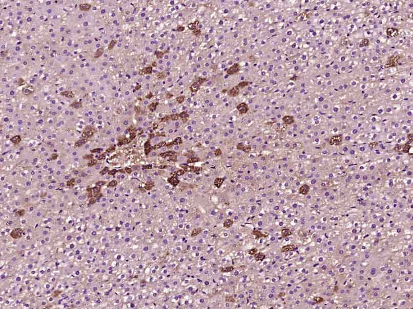Paraformaldehyde-fixed, paraffin embedded Rat liver; Antigen retrieval by boiling in sodium citrate buffer (pH6.0) for 15min; Block endogenous peroxidase by 3% hydrogen peroxide for 20 minutes; Blocking buffer (normal goat serum) at 37°C for 30min; Antibody incubation with Phosphotyrosine Monoclonal Antibody, Unconjugated (bsm-33205M) at 1:400 overnight at 4°C, DAB staining.