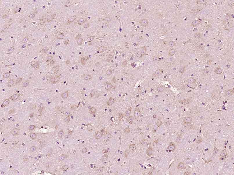 Paraformaldehyde-fixed, paraffin embedded Rat brain; Antigen retrieval by boiling in sodium citrate buffer (pH6.0) for 15min; Block endogenous peroxidase by 3% hydrogen peroxide for 20 minutes; Blocking buffer (normal goat serum) at 37°C for 30min; Antibody incubation with Phosphotyrosine Monoclonal Antibody, Unconjugated (bsm-33205M) at 1:400 overnight at 4°C, DAB staining.