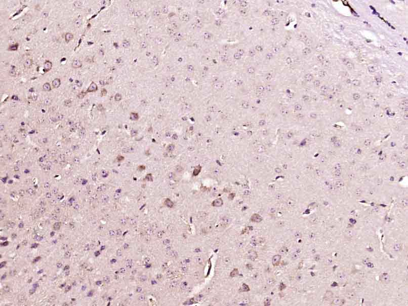 Paraformaldehyde-fixed, paraffin embedded Mouse brain; Antigen retrieval by boiling in sodium citrate buffer (pH6.0) for 15min; Block endogenous peroxidase by 3% hydrogen peroxide for 20 minutes; Blocking buffer (normal goat serum) at 37°C for 30min; Antibody incubation with Phosphotyrosine Monoclonal Antibody, Unconjugated (bsm-33205M) at 1:400 overnight at 4°C, DAB staining.