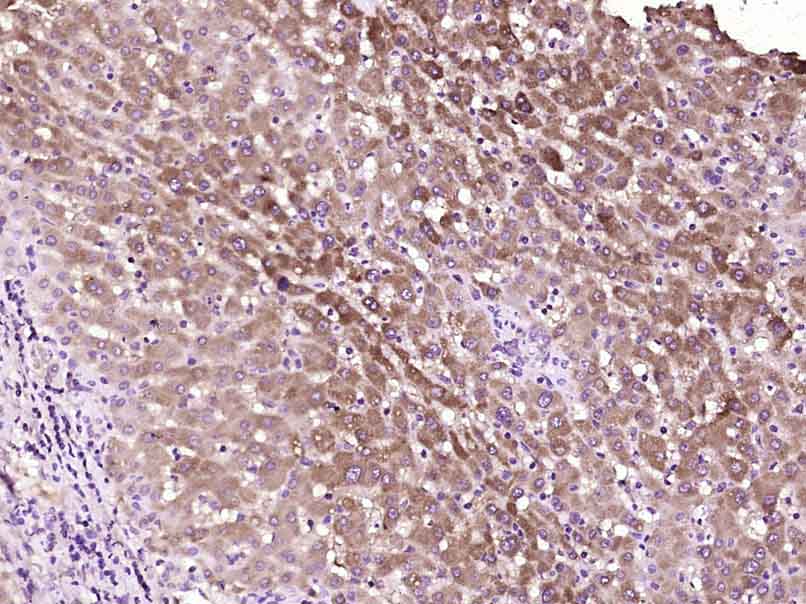Paraformaldehyde-fixed, paraffin embedded Human liver; Antigen retrieval by boiling in sodium citrate buffer (pH6.0) for 15min; Block endogenous peroxidase by 3% hydrogen peroxide for 20 minutes; Blocking buffer (normal goat serum) at 37°C for 30min; Antibody incubation with Phosphotyrosine Monoclonal Antibody, Unconjugated (bsm-33205M) at 1:400 overnight at 4°C, DAB staining.