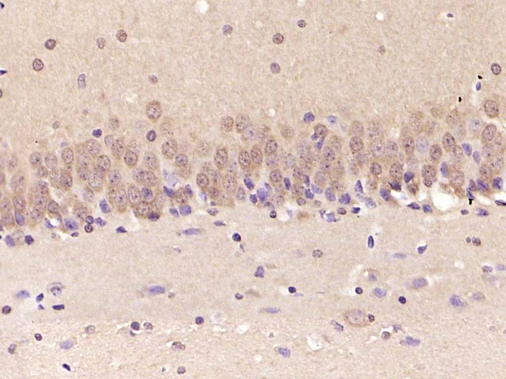 Paraformaldehyde-fixed, paraffin embedded Rat brain; Antigen retrieval by boiling in sodium citrate buffer (pH6.0) for 15min; Block endogenous peroxidase by 3% hydrogen peroxide for 20 minutes; Blocking buffer (normal goat serum) at 37°C for 30min; Antibody incubation with ERK1/2 Monoclonal Antibody, Unconjugated (bsm-33234M) at 1:2000 overnight at 4°C, DAB staining.