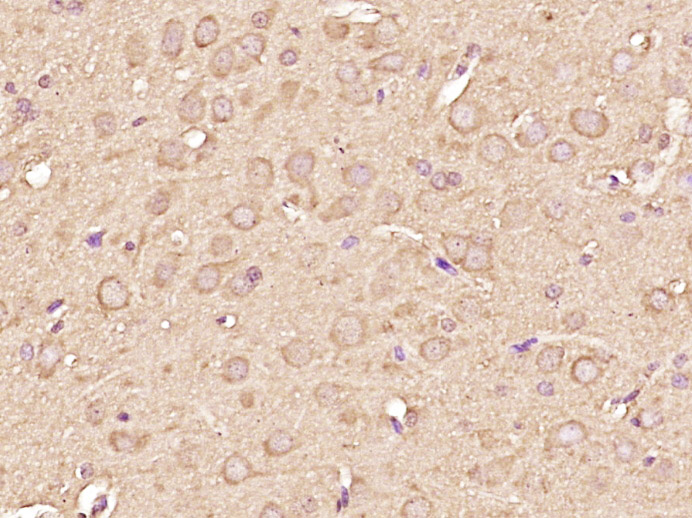 Paraformaldehyde-fixed, paraffin embedded Rat brain; Antigen retrieval by boiling in sodium citrate buffer (pH6.0) for 15min; Block endogenous peroxidase by 3% hydrogen peroxide for 20 minutes; Blocking buffer (normal goat serum) at 37°C for 30min; Antibody incubation with RPS6KB1 Monoclonal Antibody, Unconjugated (bsm-33264M) at 1:400 overnight at 4°C, DAB staining.