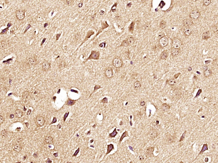 Paraformaldehyde-fixed, paraffin embedded Mouse brain; Antigen retrieval by boiling in sodium citrate buffer (pH6.0) for 15min; Block endogenous peroxidase by 3% hydrogen peroxide for 20 minutes; Blocking buffer (normal goat serum) at 37°C for 30min; Antibody incubation with Caspase-3 Monoclonal Antibody, Unconjugated (bsm-33284M) at 1:400 overnight at 4°C, DAB staining.