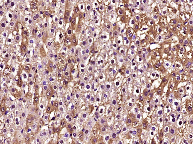 Paraformaldehyde-fixed, paraffin embedded Rat liver; Antigen retrieval by boiling in sodium citrate buffer (pH6.0) for 15min; Block endogenous peroxidase by 3% hydrogen peroxide for 20 minutes; Blocking buffer (normal goat serum) at 37°C for 30min; Antibody incubation with Caspase-3 Monoclonal Antibody, Unconjugated (bsm-33284M) at 1:400 overnight at 4°C, DAB staining.