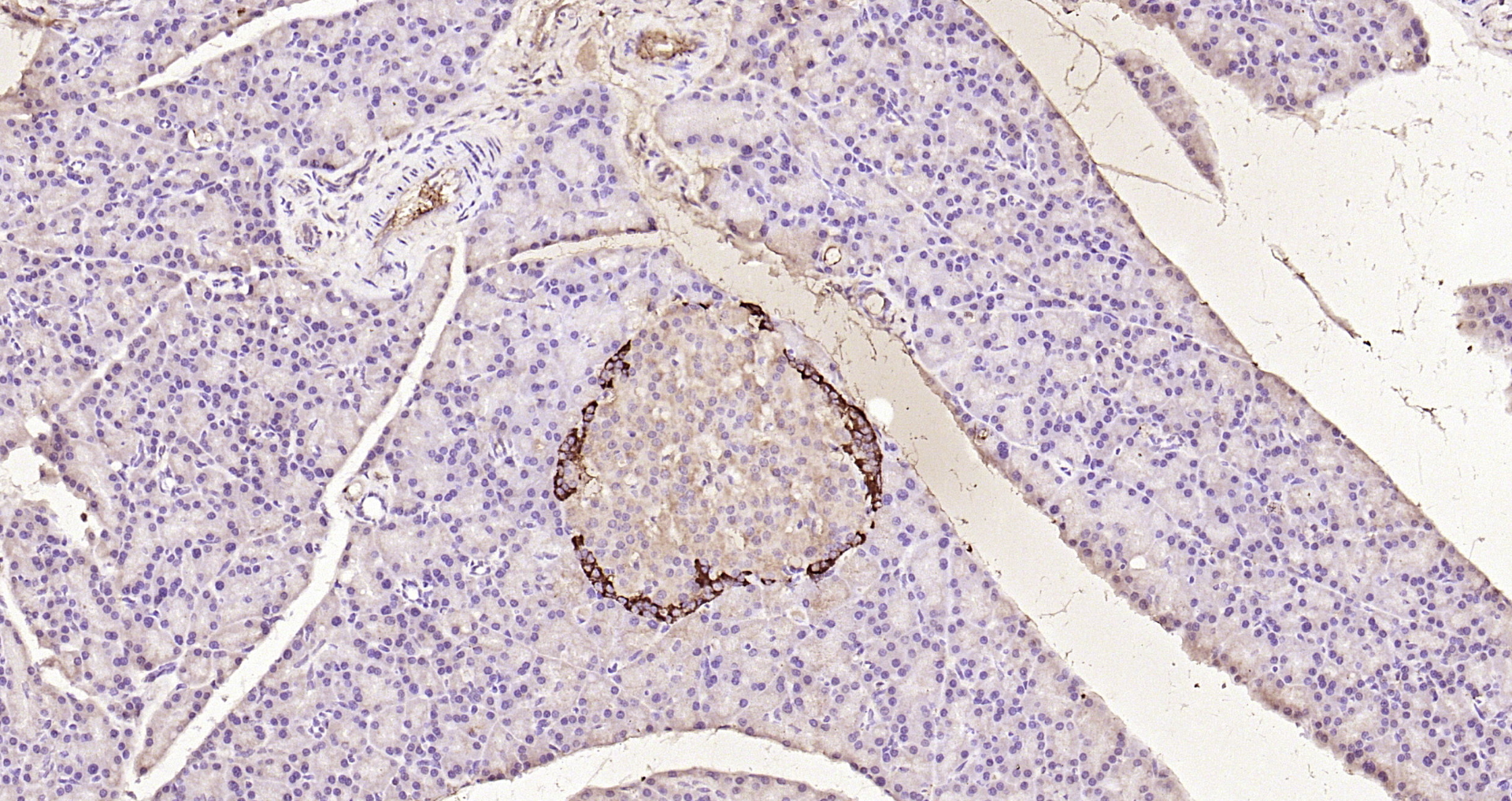 Paraformaldehyde-fixed, paraffin embedded Mouse pancreas; Antigen retrieval by boiling in sodium citrate buffer (pH6.0) for 15min; Block endogenous peroxidase by 3% hydrogen peroxide for 20 minutes; Blocking buffer (normal goat serum) at 37°C for 30min; Antibody incubation with GLP-1 Polyclonal Antibody, Unconjugated (bs-0038R) at 1:200 overnight at 4°C, DAB staining.