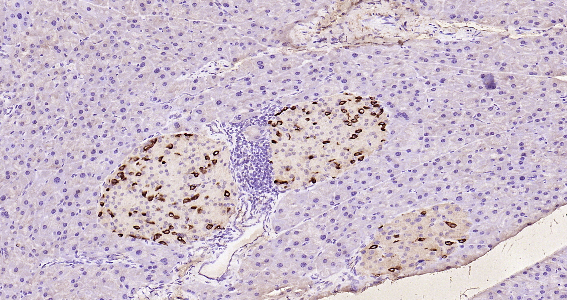 Paraformaldehyde-fixed, paraffin embedded Rat pancreas; Antigen retrieval by boiling in sodium citrate buffer (pH6.0) for 15min; Block endogenous peroxidase by 3% hydrogen peroxide for 20 minutes; Blocking buffer (normal goat serum) at 37°C for 30min; Antibody incubation with GLP-1 Polyclonal Antibody, Unconjugated (bs-0038R) at 1:200 overnight at 4°C, DAB staining.