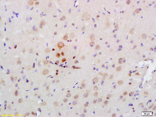 Formalin-fixed and paraffin embedded rat brain labeled with Rabbit Anti PRKAA2/AMPK alpha 2 Polyclonal Antibody, Unconjugated (bs-2771R) at 1:200 followed by conjugation to the secondary antibody and DAB staining