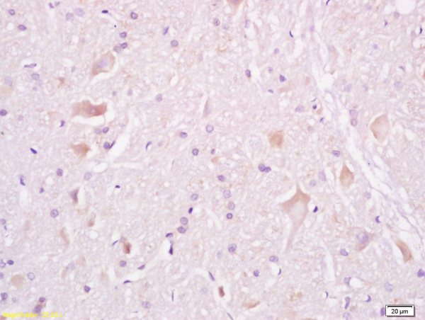 Formalin-fixed and paraffin embedded rat brain tissue labeled withAnti-Tuberin/TSC2 Polyclonal Antibody, Unconjugated(bs-3586R) at 1:200, followed by conjugation to the secondary antibody and DAB staining