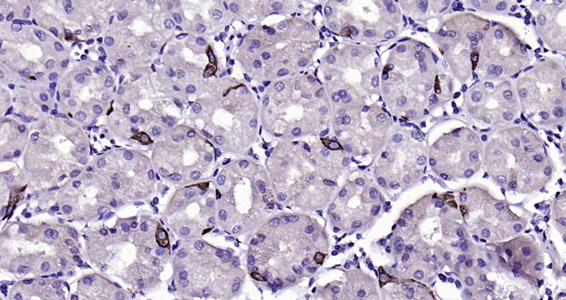 Paraformaldehyde-fixed, paraffin embedded Human stomach; Antigen retrieval by boiling in sodium citrate buffer (pH6.0) for 15min; Block endogenous peroxidase by 3% hydrogen peroxide for 20 minutes; Blocking buffer (normal goat serum) at 37°C for 30min; Antibody incubation with Chromogranin A Polyclonal Antibody, Unconjugated (bs-0539R) at 1:200 overnight at 4°C, DAB staining.