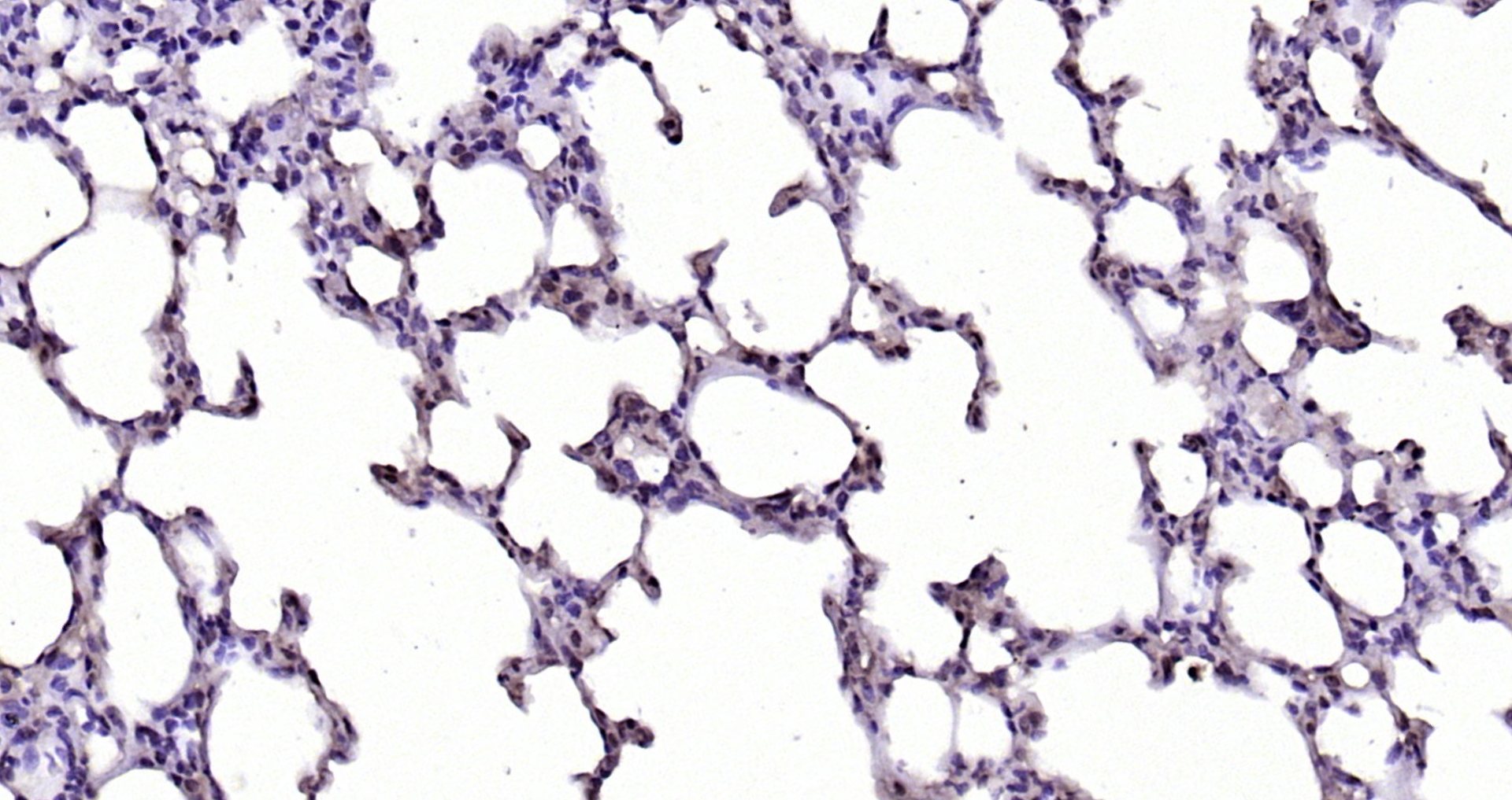 Paraformaldehyde-fixed, paraffin embedded Rat lung; Antigen retrieval by boiling in sodium citrate buffer (pH6.0) for 15min; Block endogenous peroxidase by 3% hydrogen peroxide for 20 minutes; Blocking buffer (normal goat serum) at 37°C for 30min; Antibody incubation with CDK7 Polyclonal Antibody, Unconjugated (bs-0569R) at 1:200 overnight at 4°C, DAB staining.