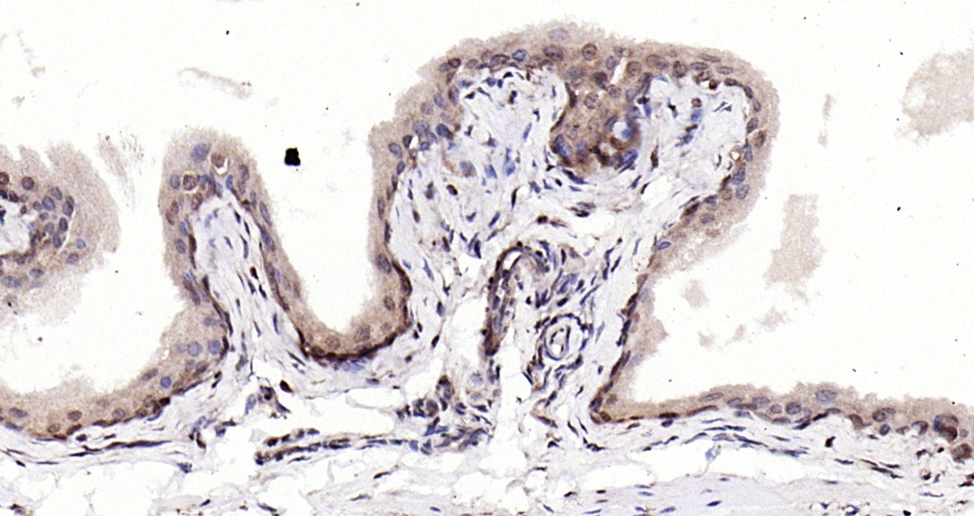 Paraformaldehyde-fixed, paraffin embedded Rat bladder; Antigen retrieval by boiling in sodium citrate buffer (pH6.0) for 15min; Block endogenous peroxidase by 3% hydrogen peroxide for 20 minutes; Blocking buffer (normal goat serum) at 37°C for 30min; Antibody incubation with S100A4 Polyclonal Antibody, Unconjugated (bs-3759R) at 1:200 overnight at 4°C, DAB staining.