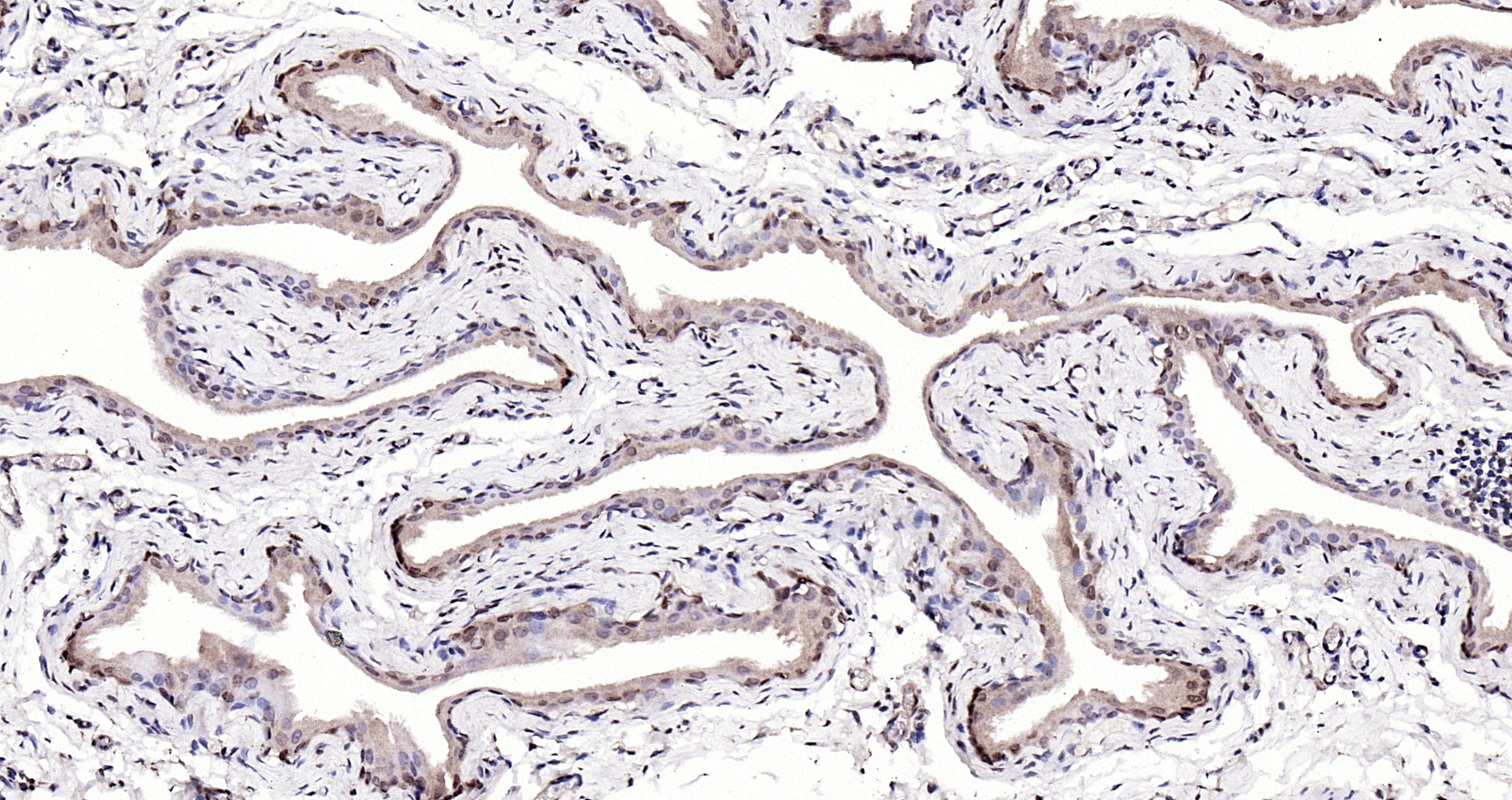 Paraformaldehyde-fixed, paraffin embedded Mouse bladder; Antigen retrieval by boiling in sodium citrate buffer (pH6.0) for 15min; Block endogenous peroxidase by 3% hydrogen peroxide for 20 minutes; Blocking buffer (normal goat serum) at 37°C for 30min; Antibody incubation with S100A4 Polyclonal Antibody, Unconjugated (bs-3759R) at 1:200 overnight at 4°C, DAB staining.