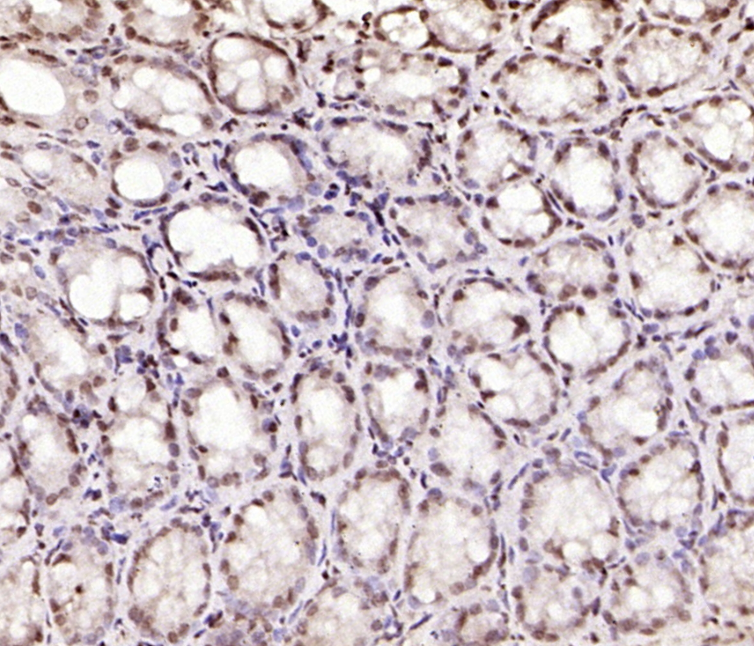IHC-Paraffin staining of mouse colon using bs-7716R (SPC25 Polyclonal Antibody).
