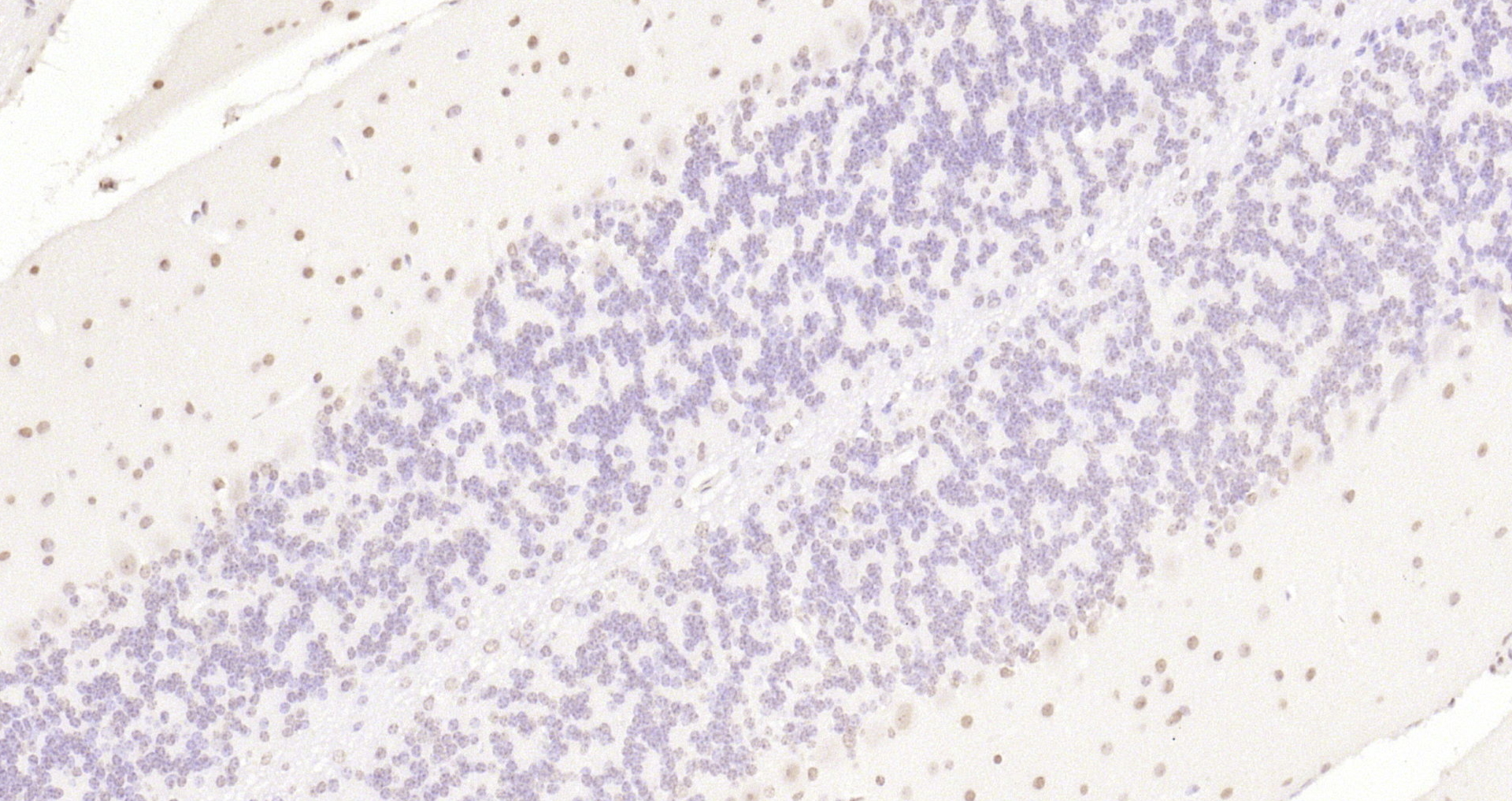 Paraformaldehyde-fixed, paraffin embedded Mouse cerebellum; Antigen retrieval by boiling in sodium citrate buffer (pH6.0) for 15min; Block endogenous peroxidase by 3% hydrogen peroxide for 20 minutes; Blocking buffer (normal goat serum) at 37°C for 30min; Antibody incubation with KLHL7 Polyclonal Antibody, Unconjugated (bs-5935R) at 1:200 overnight at 4°C, DAB staining.