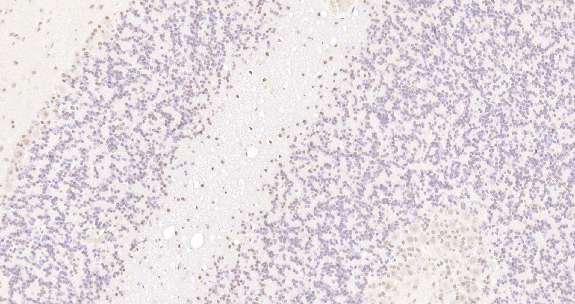 Paraformaldehyde-fixed, paraffin embedded Rat cerebellum; Antigen retrieval by boiling in sodium citrate buffer (pH6.0) for 15min; Block endogenous peroxidase by 3% hydrogen peroxide for 20 minutes; Blocking buffer (normal goat serum) at 37°C for 30min; Antibody incubation with KLHL7 Polyclonal Antibody, Unconjugated (bs-5935R) at 1:200 overnight at 4°C, DAB staining.