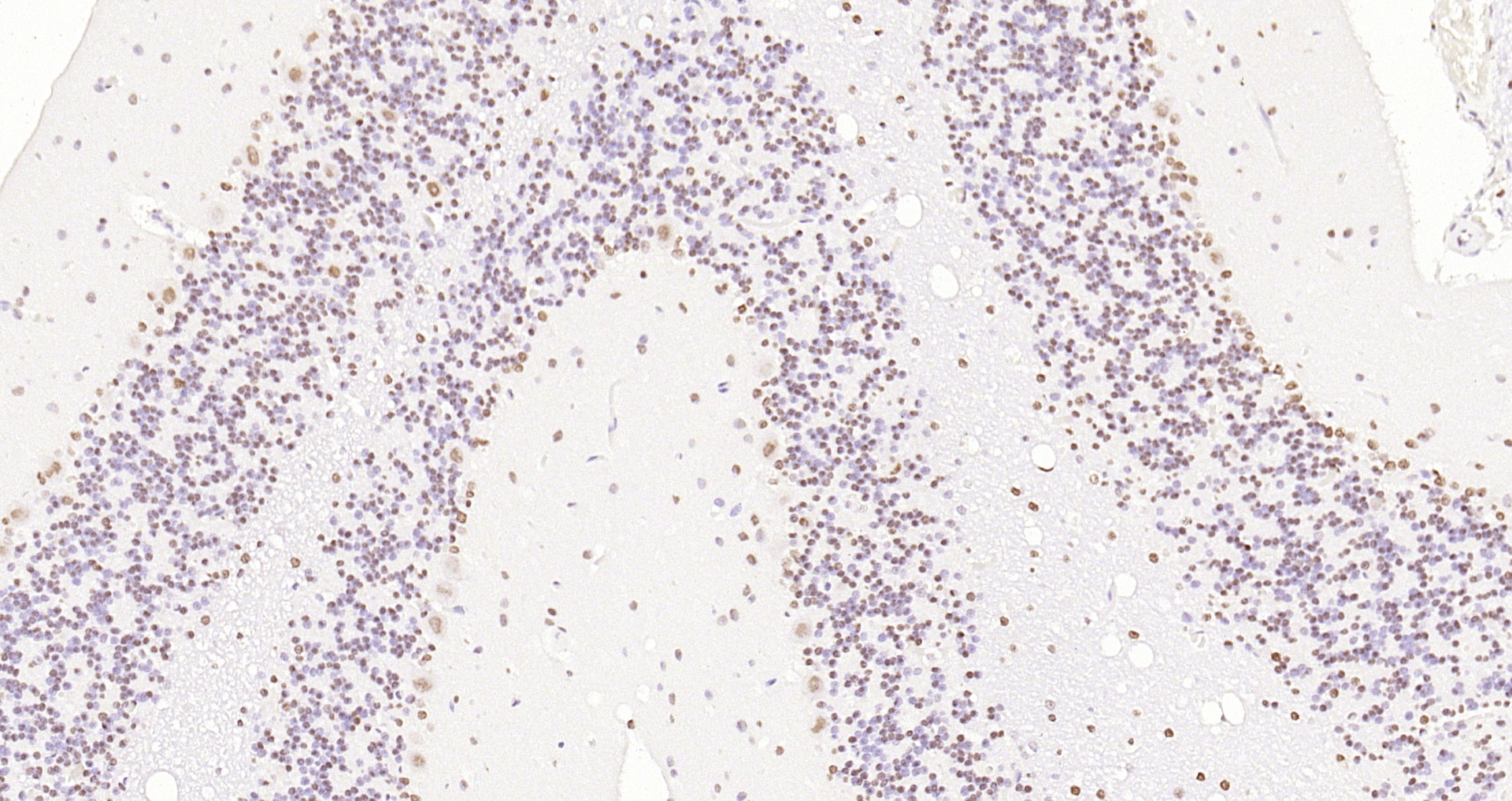 Paraformaldehyde-fixed, paraffin embedded Rat cerebellum; Antigen retrieval by boiling in sodium citrate buffer (pH6.0) for 15min; Block endogenous peroxidase by 3% hydrogen peroxide for 20 minutes; Blocking buffer (normal goat serum) at 37°C for 30min; Antibody incubation with B MyB Polyclonal Antibody, Unconjugated (bs-5960R) at 1:200 overnight at 4°C, DAB staining.