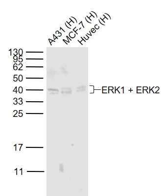 Lane 1: Human A431 cell lysates; Lane 2: Human MCF-7 cell lysates; Lane 3: Human HUVEC cell lysates probed with ERK1 + ERK2 Polyclonal Antibody, Unconjugated (bs-0022R) at 1:1000 dilution and 4˚C overnight incubation. Followed by conjugated secondary antibody incubation at 1:20000 for 60 min at 37˚C.