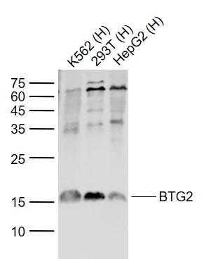 Lane 1: Human K562 cell lysates; Lane 2: Human 293T cell lysates; Lane 3: Human HepG2 cell lysates probed with BTG2 Polyclonal Antibody, Unconjugated (bs-0031R) at 1:1000 dilution and 4˚C overnight incubation. Followed by conjugated secondary antibody incubation at 1:20000 for 60 min at 37˚C.