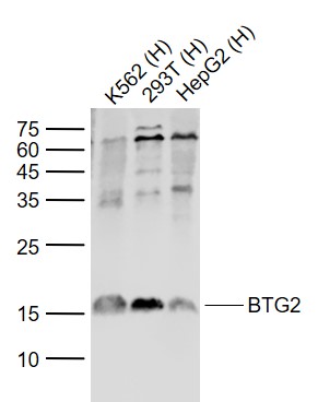 Lane 1: Human K562 cell lysates; Lane 2: Human 293T cell lysates; Lane 3: Human HepG2 cell lysates probed with BTG2 Polyclonal Antibody, Unconjugated (bs-0031R) at 1:1000 dilution and 4°C overnight incubation. Followed by conjugated secondary antibody incubation at 1:20000 for 60 min at 37°C.