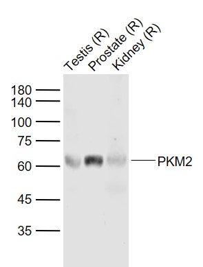Lane 1: Rat Testis lysates; Lane 2: Rat Prostate lysates; Lane 3: Rat Kidney lysates probed with PKM2 Polyclonal Antibody, Unconjugated (bs-0101R) at 1:1000 dilution and 4˚C overnight incubation. Followed by conjugated secondary antibody incubation at 1:20000 for 60 min at 37˚C.