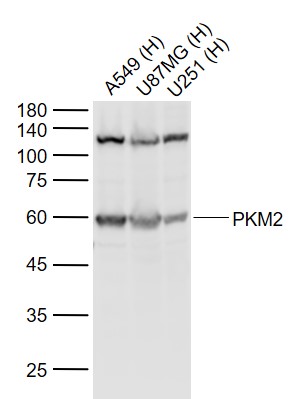 Lane 1: Human A549 cell lysates; Lane 2: Human U-87MG cell lysates; Lane 3: Human U251 cell lysates probed with M2-PK Polyclonal Antibody, Unconjugated (bs-0102M) at 1:1000 dilution and 4˚C overnight incubation. Followed by conjugated secondary antibody incubation at 1:20000 for 60 min at 37˚C.