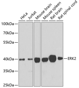 Lane 1: Human Hela cell lysates; Lane 2: Human Jurkat cell lysates; Lane 3: Mouse Brain lysates; Lane 4: Mouse Spleen lysates; Lane 5: Rat Brain lysates; Lane 6: Rat Spinal node lysates probed with ERK2 Polyclonal Antibody, Unconjugated (bs-55069R) at 1:1000 dilution and 4˚C overnight incubation. Followed by conjugated secondary antibody incubation at 1:20000 for 60 min at 37˚C.