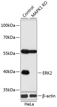 Lane 1: Hela cell lysates; Lane 2: ERK2 knockout (KO) HeLa cell lysates probed with ERK2 Polyclonal Antibody, Unconjugated (bs-55069R) at 1:1000 dilution and 4˚C overnight incubation. Followed by conjugated secondary antibody incubation at 1:20000 for 60 min at 37˚C.