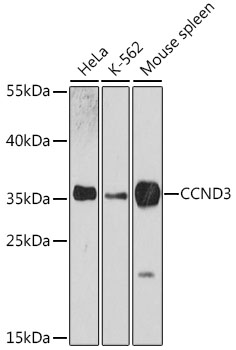 Lane 1: Human Hela cell lysates; Lane 2: Human K562 cell lysates; Lane 3: Mouse Spleen lysates probed with CCND3 Polyclonal Antibody, Unconjugated (bs-55038R) at 1:1000 dilution and 4˚C overnight incubation. Followed by conjugated secondary antibody incubation at 1:20000 for 60 min at 37˚C.