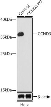 Lane 1: Hela cell lysates; Lane 2: CCND3 knockout (KO) HeLa cell lysates probed with CCND3 Polyclonal Antibody, Unconjugated (bs-55038R) at 1:1000 dilution and 4˚C overnight incubation. Followed by conjugated secondary antibody incubation at 1:20000 for 60 min at 37˚C.