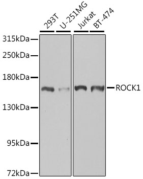 Lane 1: Human 293T cell lysates; Lane 2: Human U-251MG cell lysates; Lane 3: Human Jurkat cell lysates; Lane 4: Human BT-474 cell lysates probed with ROCK1 Polyclonal Antibody, Unconjugated (bs-55188R) at 1:1000 dilution and 4˚C overnight incubation. Followed by conjugated secondary antibody incubation at 1:20000 for 60 min at 37˚C.