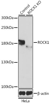 Lane 1: Hela cell lysates; Lane 2: ROCK1 knockout (KO) HeLa cell lysates probed with ROCK1 Polyclonal Antibody, Unconjugated (bs-55188R) at 1:1000 dilution and 4˚C overnight incubation. Followed by conjugated secondary antibody incubation at 1:20000 for 60 min at 37˚C.