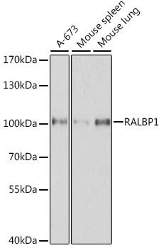 Lane 1: Human A673 cell lysates; Lane 2: Mouse spleen lysates; Lane 3: Mouse lung lysates probed with RALBP1 Polyclonal Antibody, Unconjugated (bs-55186R) at 1:1000 dilution and 4˚C overnight incubation. Followed by conjugated secondary antibody incubation at 1:20000 for 60 min at 37˚C.