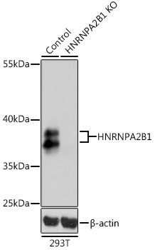 Lane 1: 293T cell lysates; Lane 2: HNRNPA2B1 knockout (KO) 293T cell lysates probed with HNRNPA2B1 Polyclonal Antibody, Unconjugated (bs-55101R) at 1:1000 dilution and 4˚C overnight incubation. Followed by conjugated secondary antibody incubation at 1:20000 for 60 min at 37˚C.